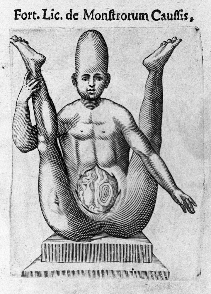 人間の怪物：巨大な頭蓋骨を持ち、明らかに腸がある生物。イタリアの