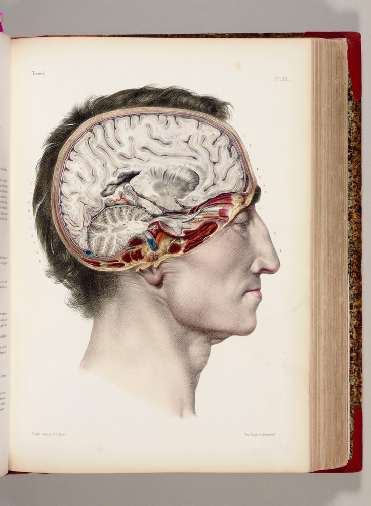 「人体の解剖学に関する完全な論文、手術医学の理解」、1831-54年から、脳を示す解剖された頭部の手彩色リトグラフ