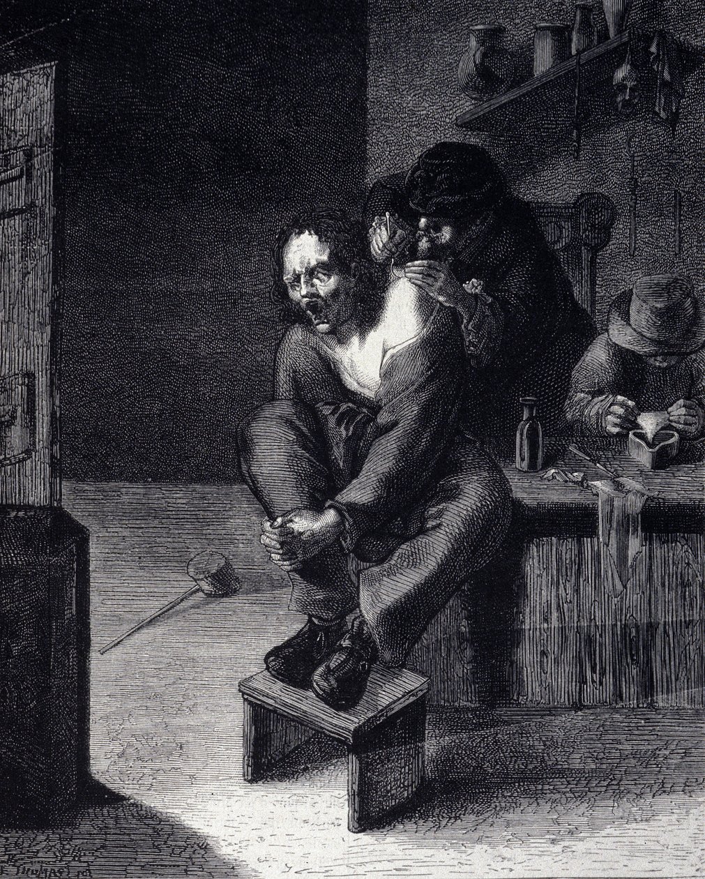 外科手術 アドリアン・ブラウワー（1608年生まれ）の絵画に基づくエングレービング 17世紀 作： Adriaen（後）Brouwer