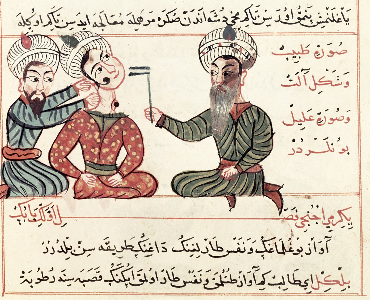 Ms Sup Turc 693 fol.29v Scrofulaの焼灼、1466 作： キャラフエディン