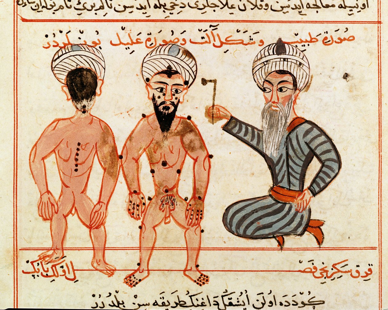 Ms Sup Turc 693 fol.46vハンセン病病変の焼灼、1466 作： キャラフエディン