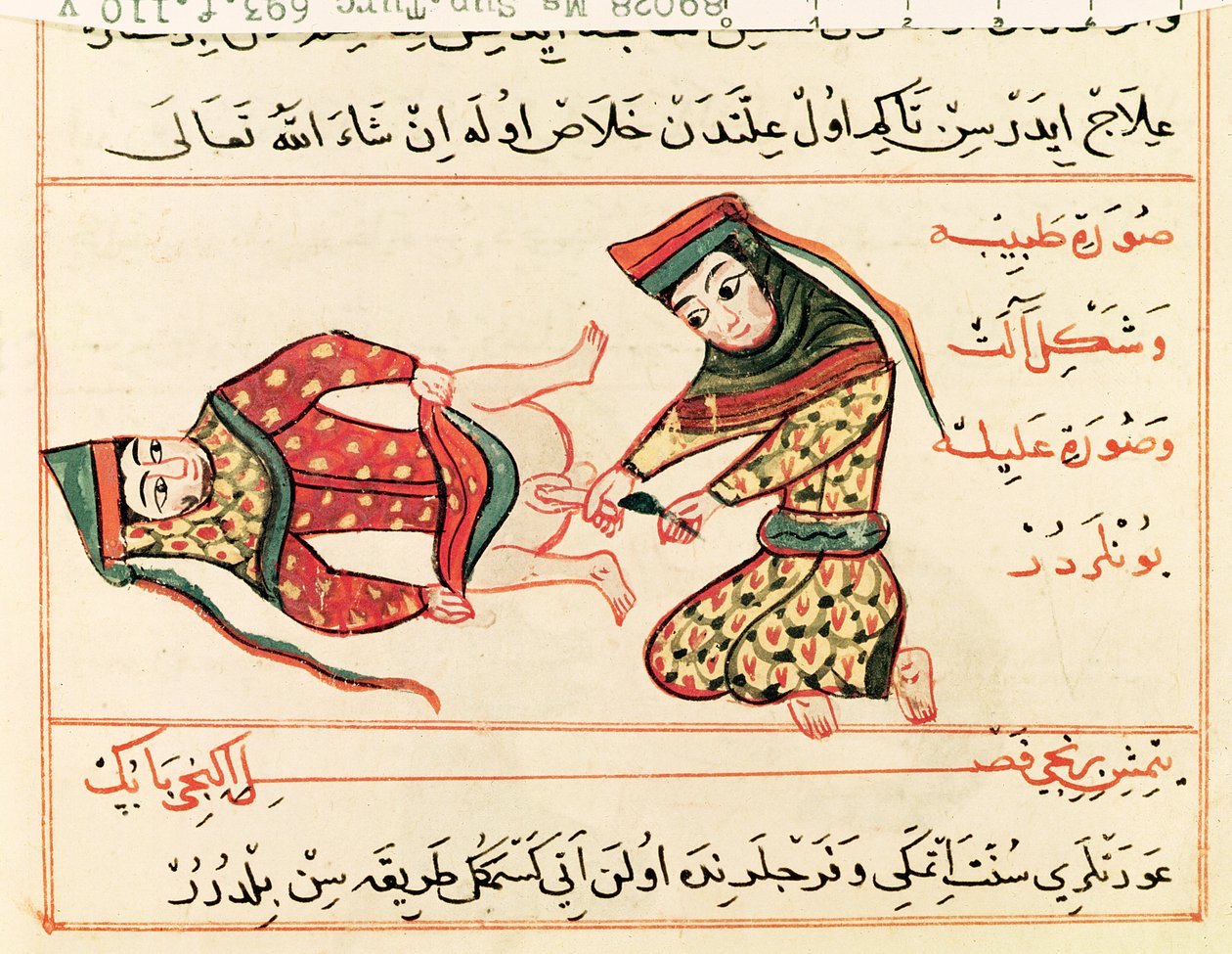 Ms Sup Turc 693 fol.110v助産師による両性具有者の手術、1466 作： キャラフエディン