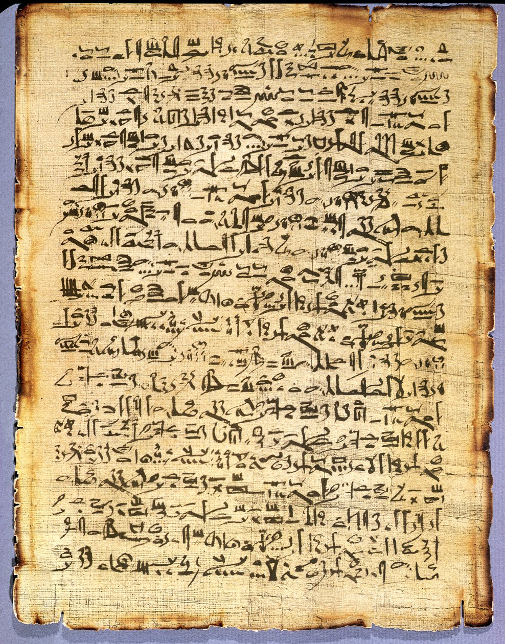 エドウィンスミスメディカルパピルスのファクシミリコピー、紀元前1600〜1500年頃のパピルス（パピルス） 作： エジプト人