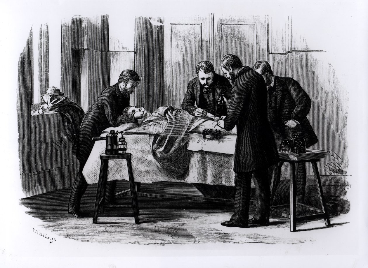 消毒手術、1882 作： 英語学校