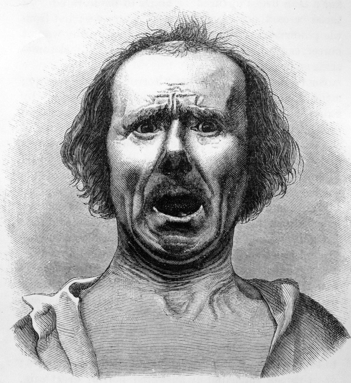 1872年に発行されたチャールズダーウィンの「人と動物の感情の表現」の図解、デュシェンヌ博士の写真からコピーされた恐怖と苦悩 作： 英語学校