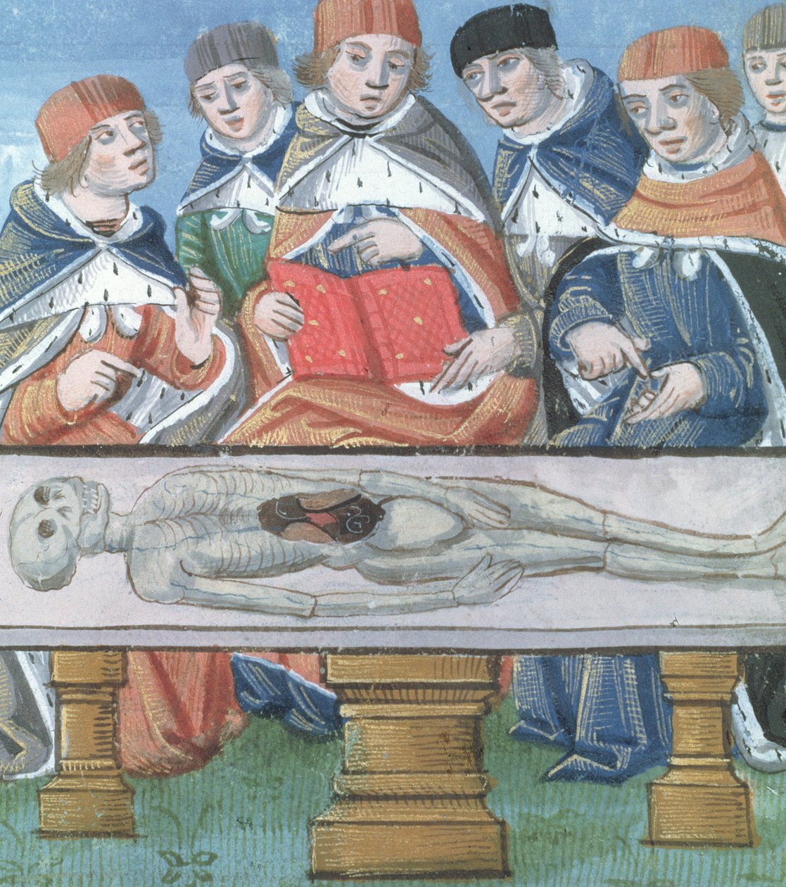 Ms Hunter 9 f.34r Dissection、De Medina Fen I. II、Avicenna（980-1037） 作： フランドルの学校