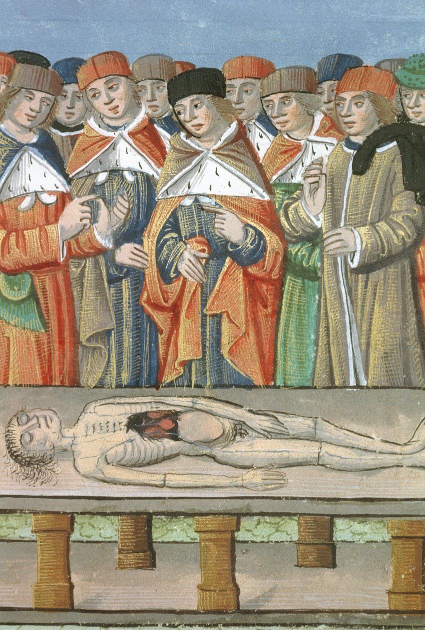 Ms Hunter 9 f.36r Dissection、De Medina Fen I. II、Avicenna（980-1037） 作： フランドルの学校