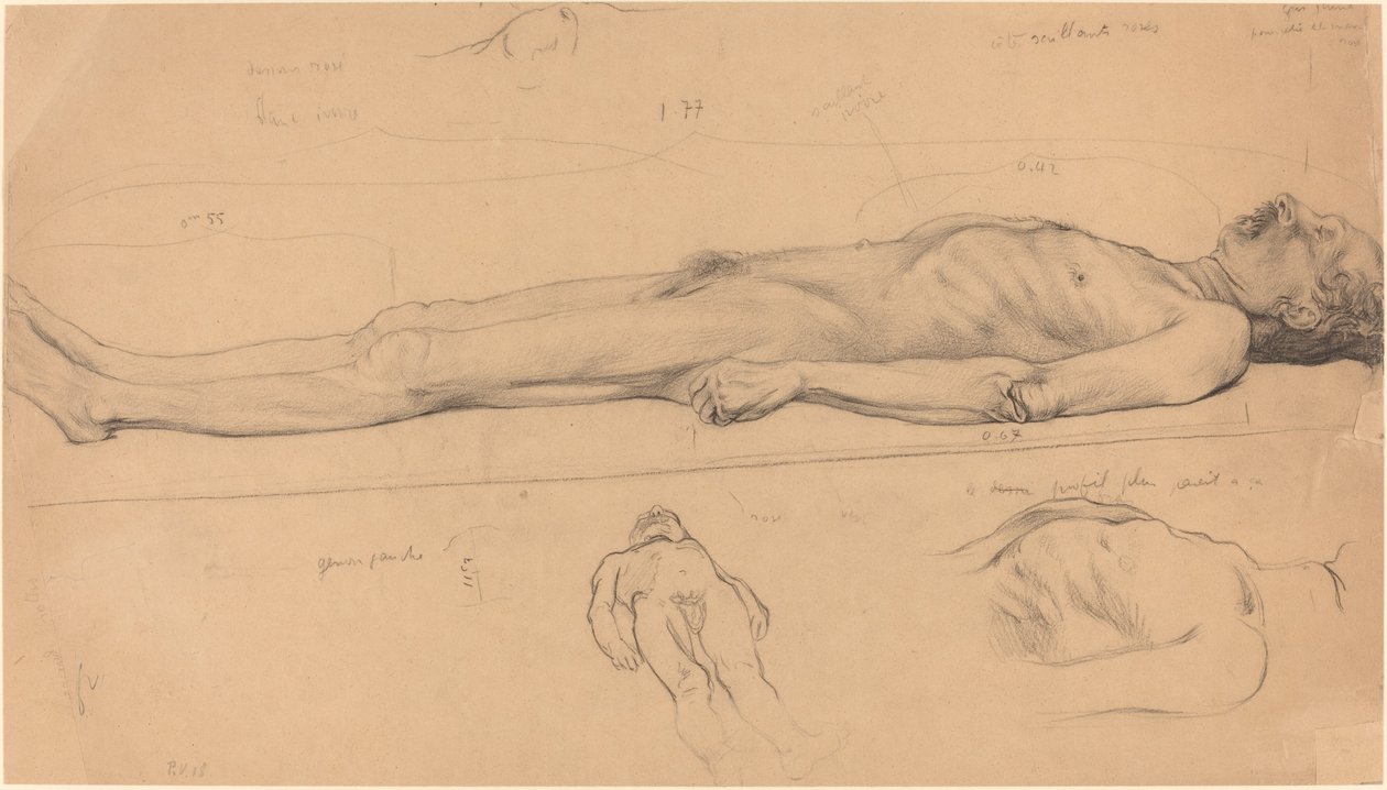 死んだキリストのための死体研究、1893年。 作： フェリックス・ヴァロットン