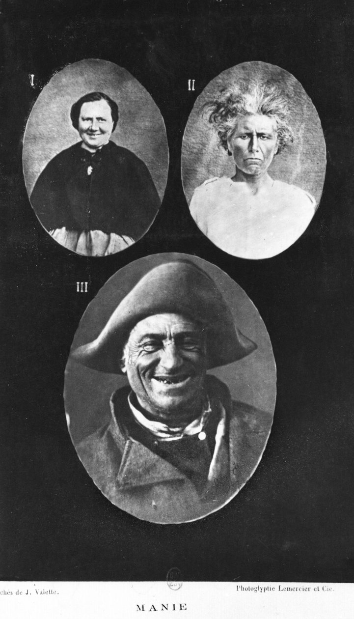 マニア、アンリダゴネット（1823-1902）、パリ、バイリエール、1876年による精神疾患の新しい初歩的かつ実用的な治療のイラスト 作： フランスの写真家