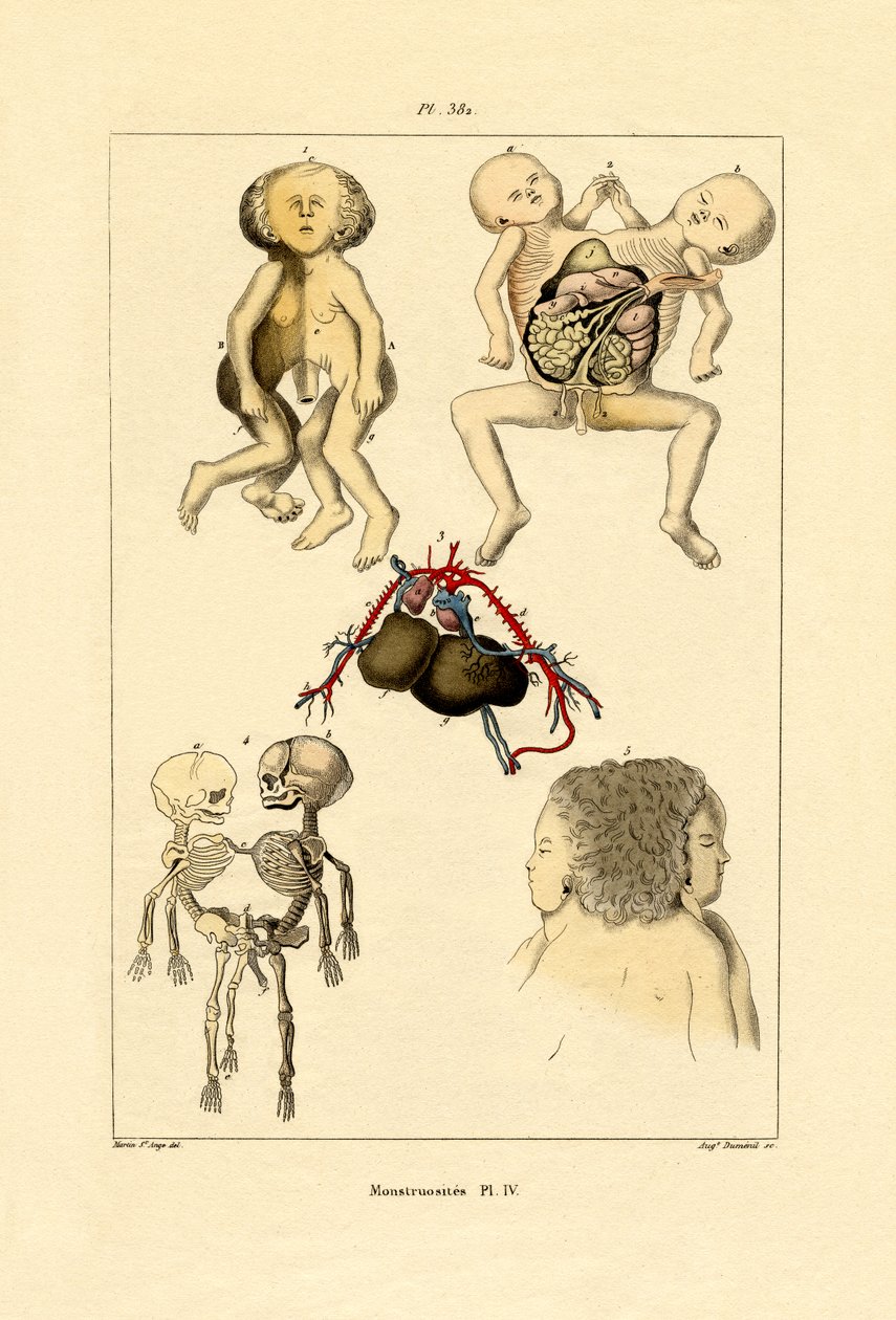 フリーク、1833-39 作： フランス語学校
