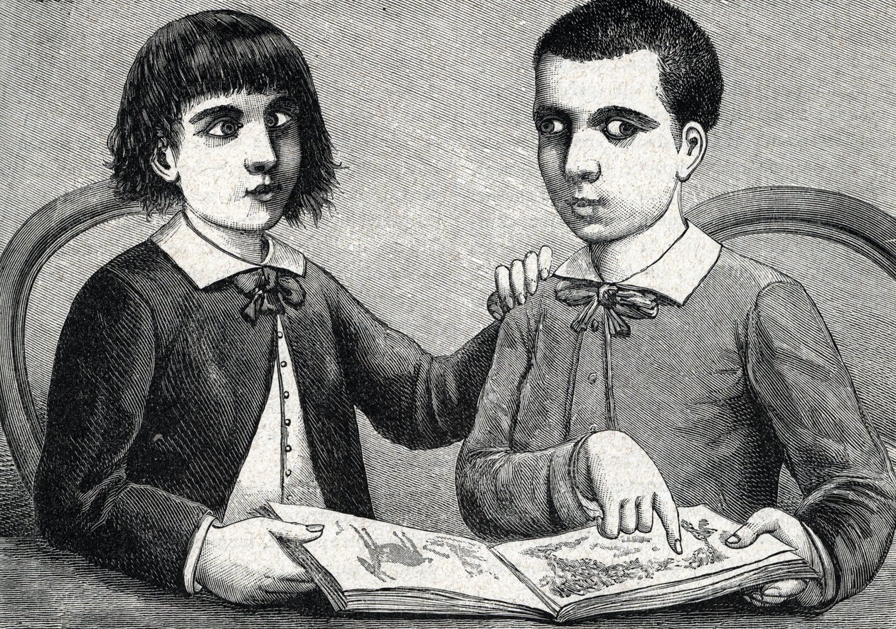 収束斜視と発散斜視の子供（彫刻） 1888年 作： フランス語学校