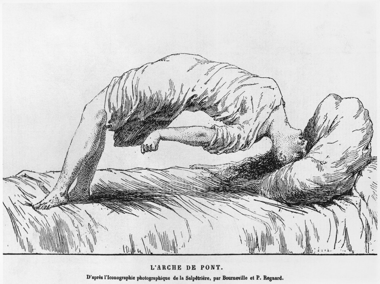 Les Maladies Epidemiques de lEspritのPaul Regnard（1850-1927）1884によるヒステリーと不眠症 作： フランス語学校