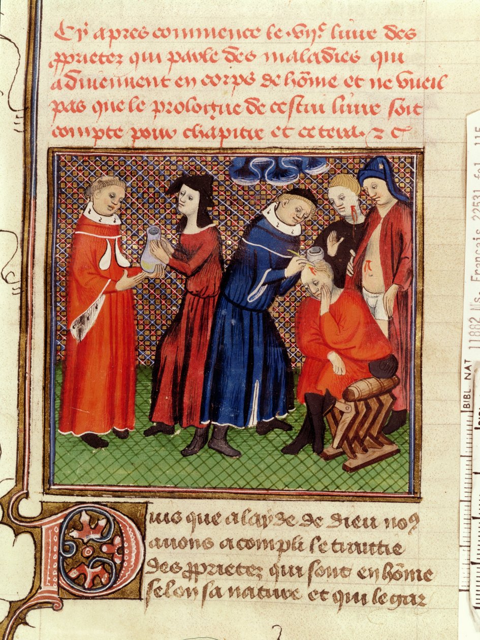 Ms Fr 22531 Fol.115尿検査と創傷の治癒、バルセルミー・ラングレースによるLe Livre des Proprietes des Choses作、c.1410-15 作： フランス語学校