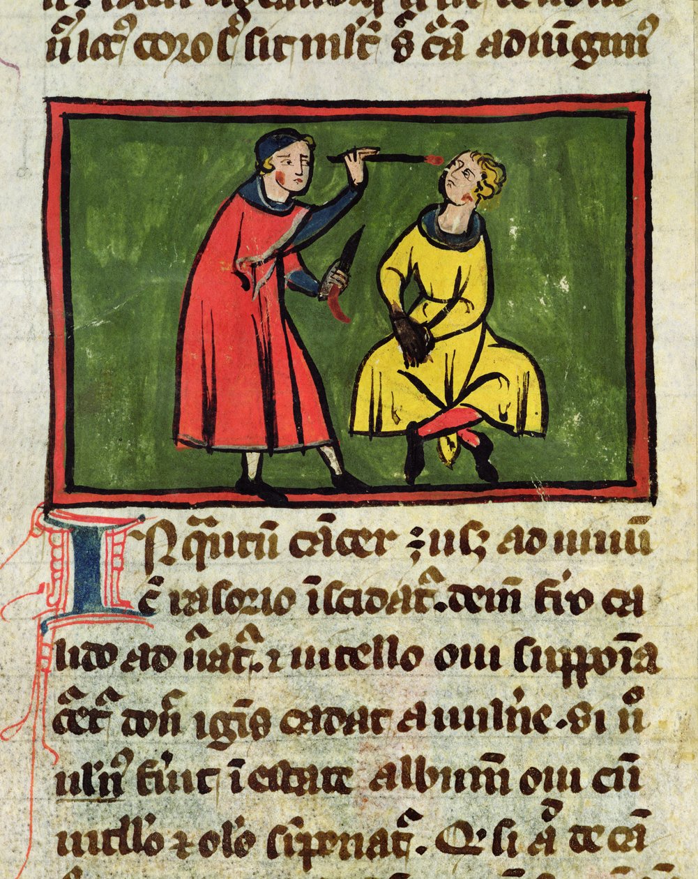 Ms H 89外科治療、Rogier de Salerne著 『Book of Surgery』から 作： フランス語学校