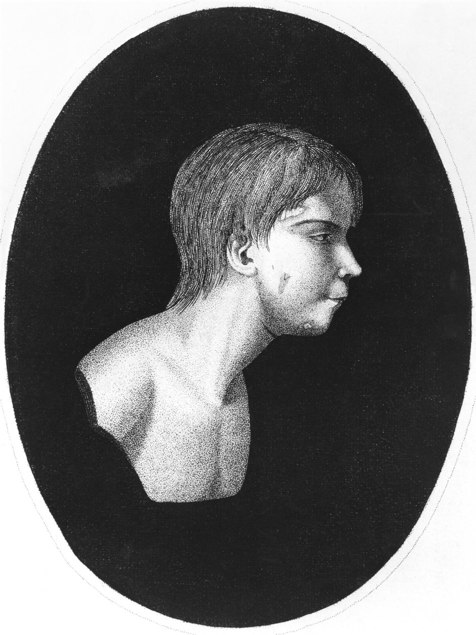 JEItardによるDe lEducation dun homme sauvageの前作、アヴェロンのビクター 作： フランス語学校