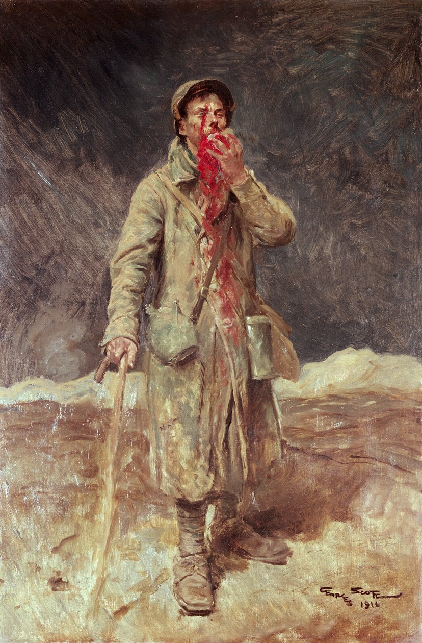 負傷した兵士、1916 作： ジョルジュ・バーティン・スコット