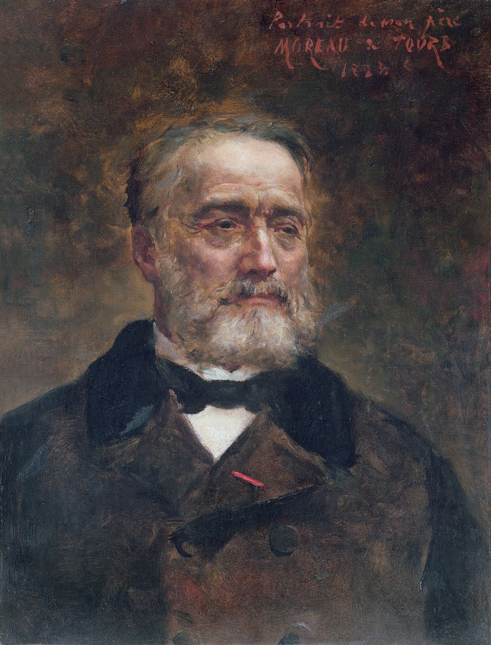 ジャック=ジョセフ・モロー・ド・ツアー（1804-84）1884 作： ジョルジュ・モロー・ド・トゥール