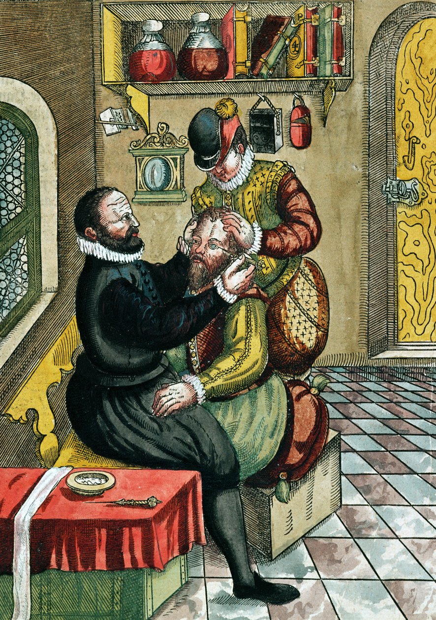 白内障手術、1583年にドレスデンで出版されたGeorg Bartisch（1535-1636）によるOphthalmodouleiaから（カラー木版印刷） 作： ドイツ語学校