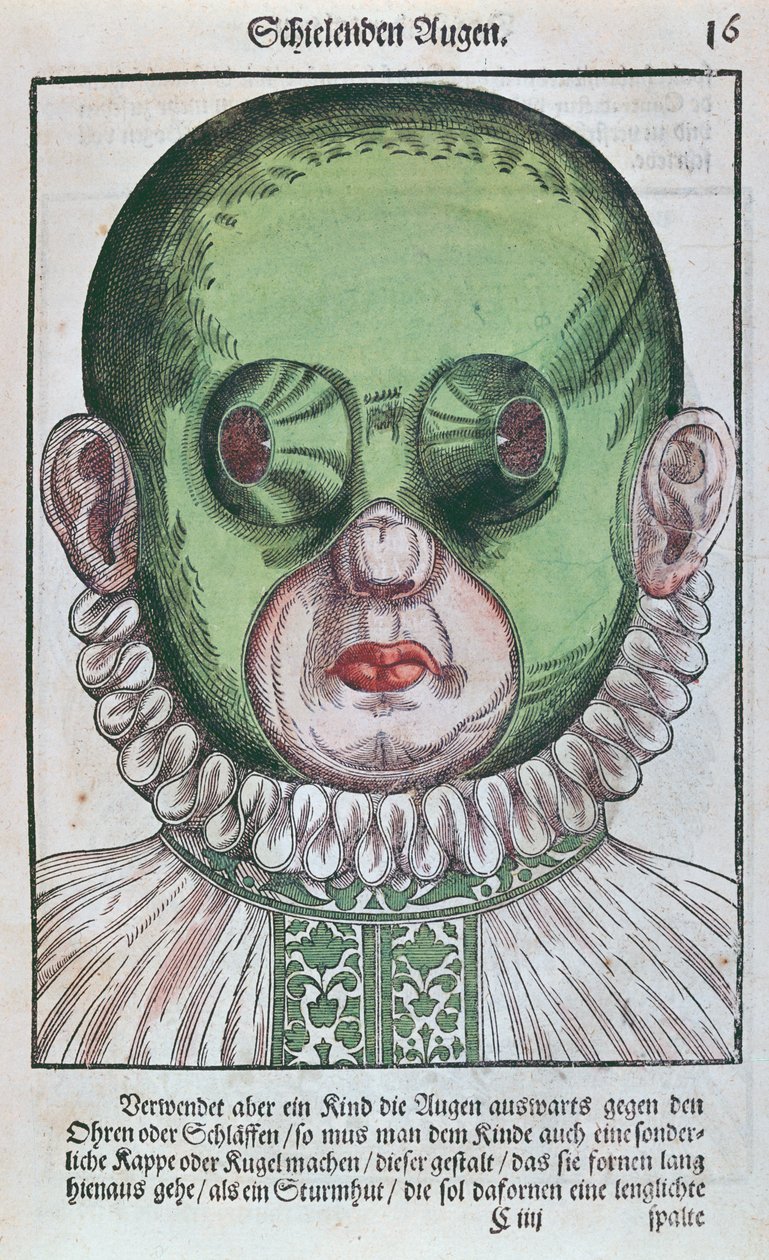 眼帯を治療するためのマスク。眼科治療用のマスクで、1583年にドレスデンで出版されたGeorg Bartisch（1535-1636）によるOcolourmodouleia（色の木版画） 作： ドイツ語学校