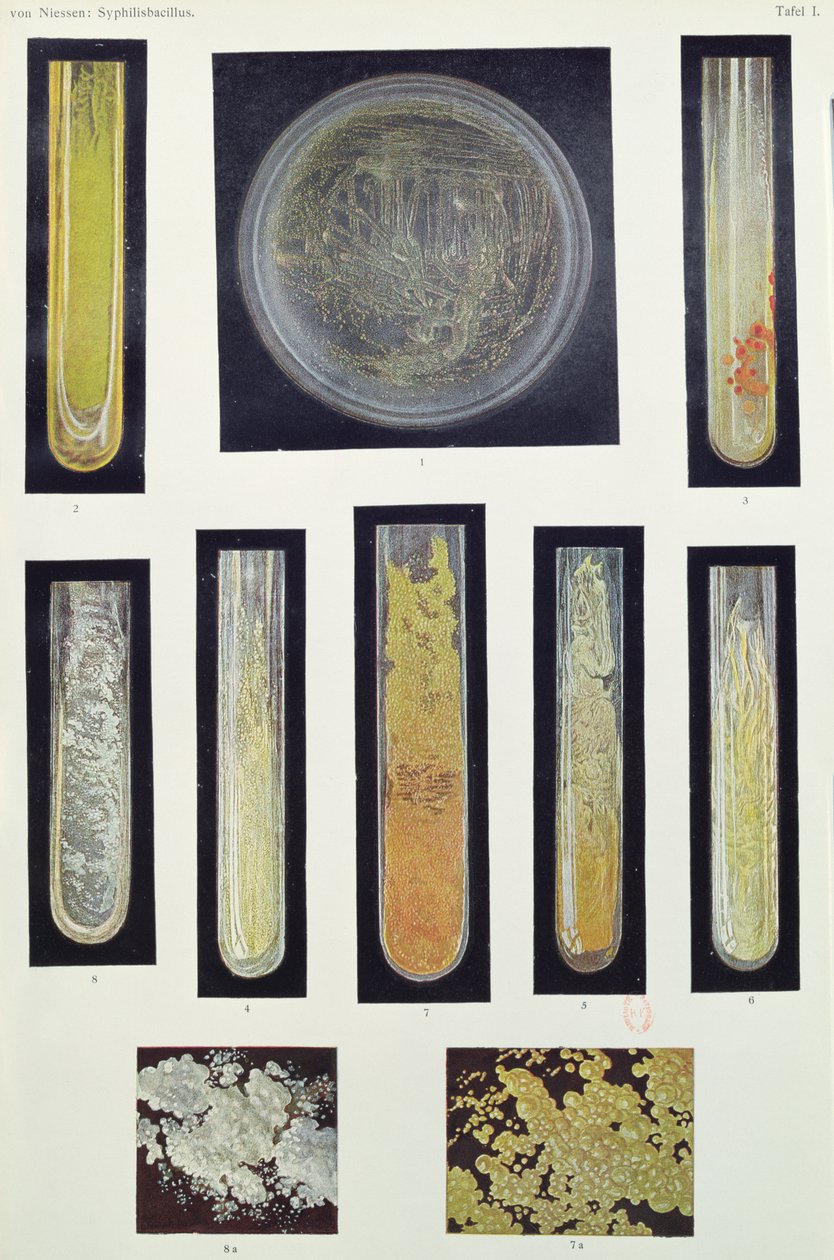 Syphilus Bacillus、マックスフォンニーセン著、ライプツィヒ、1908年 作： ドイツ語学校