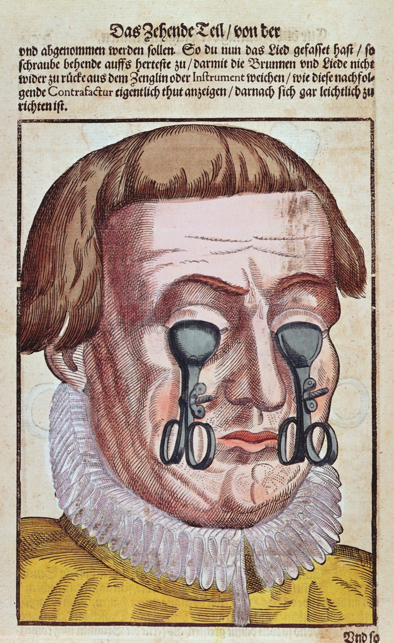 眼の状態の治療、1583年にドレスデンで出版されたGeorg Bartisch（1535-1636）によるOphthalmodouleiaから（カラー木版画） 作： ドイツ語学校