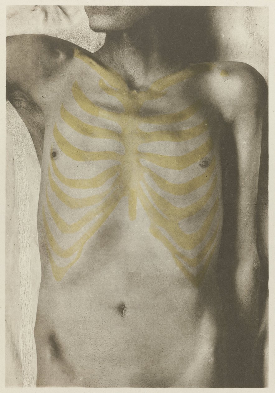 Anatomical foto van een mannelijk lijk: 