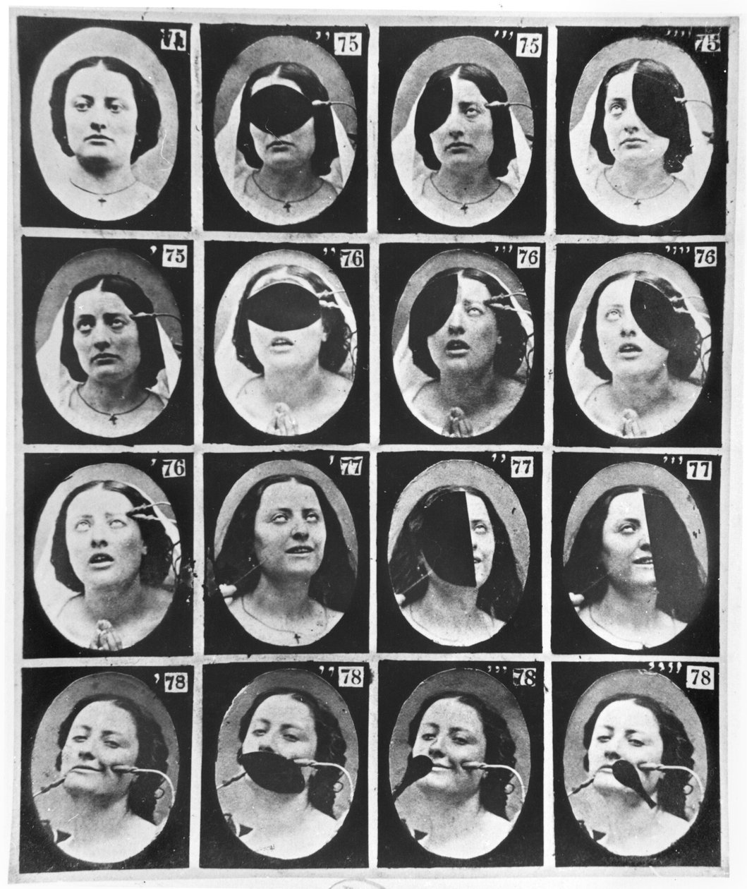 1876年パリ発行のDuchenne de Boulogneによる「Mechanisme de la Physionomie humaine ou analyze electrophysiologique des passions」からの生理学的研究 作： ギヨーム・ベンジャミン・アルマン・デュシェンヌ・ド・ブローニュ