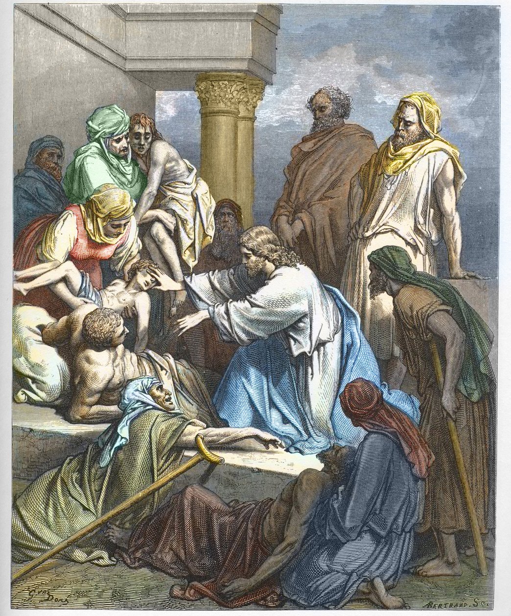 Jesus guerit les malades - Jesus healing the sick - - Gustave Dore (1832-1883) の "The Bible illustree" のエングレーヴィング - "The Dore Bible" のエングレーヴィング 作： ギュスターヴ・ドレ
