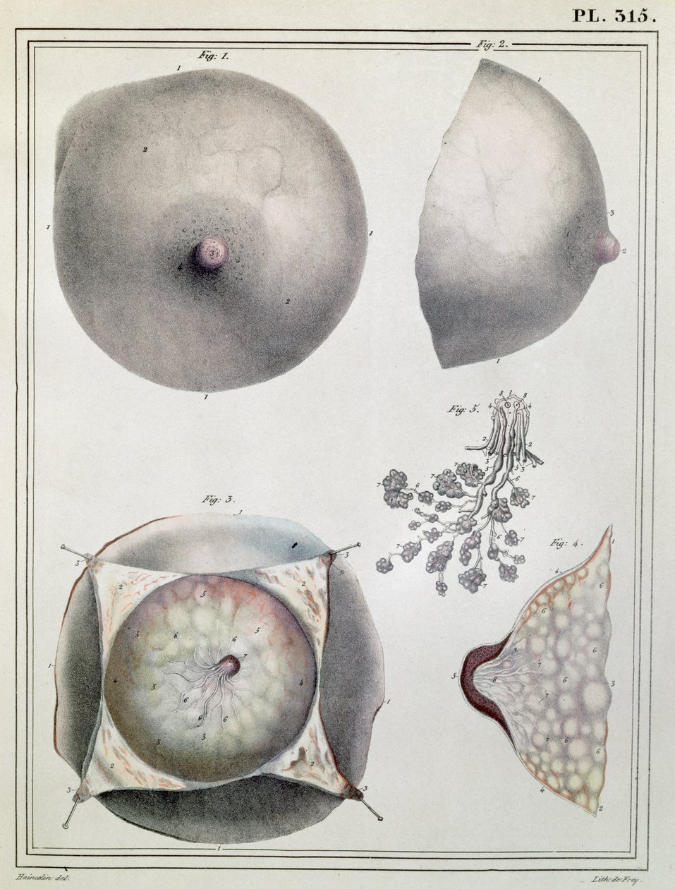 1825年にG.ドフレイによって彫刻されたジュールクロケ作「Manuel d&39;Anatomie descriptive du Corps Humain」からの乳房の解剖学 作： ハインスリン