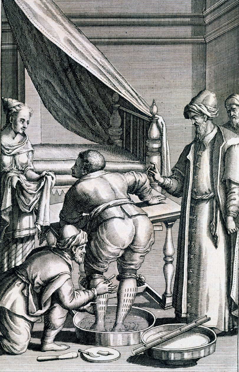 1745年に出版されたProspero AlpiniによるMedicina Aegyptiorumからの脚の流血 作： イタリア語学校