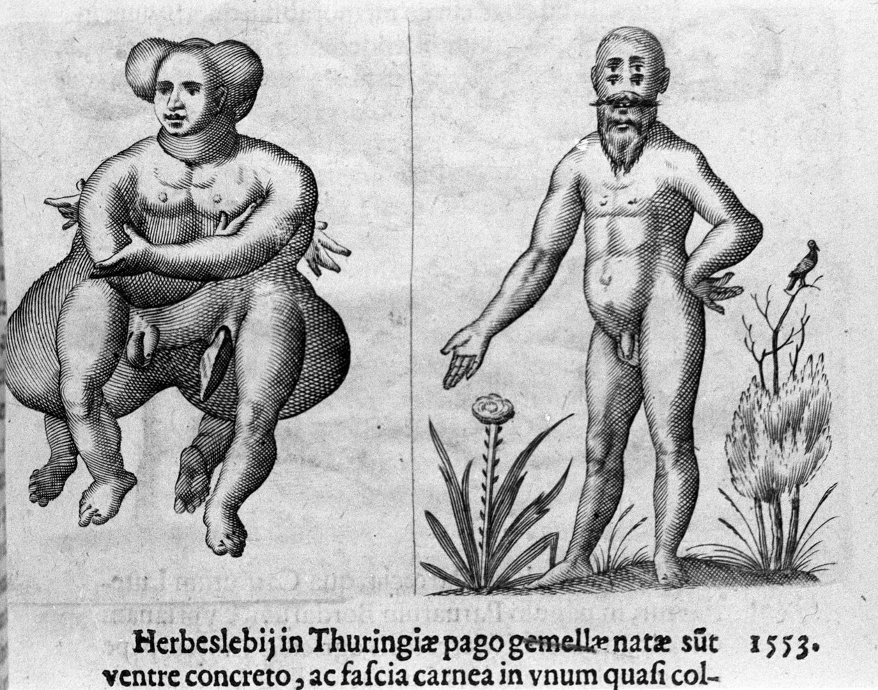 さまざまなタイプの人間の怪物。イタリアの科学者Fortunio Liceti (1577-1656)の「De monstrorum natura, causis et differentiis」からのエングレーヴィング。1646 作： イタリア語学校