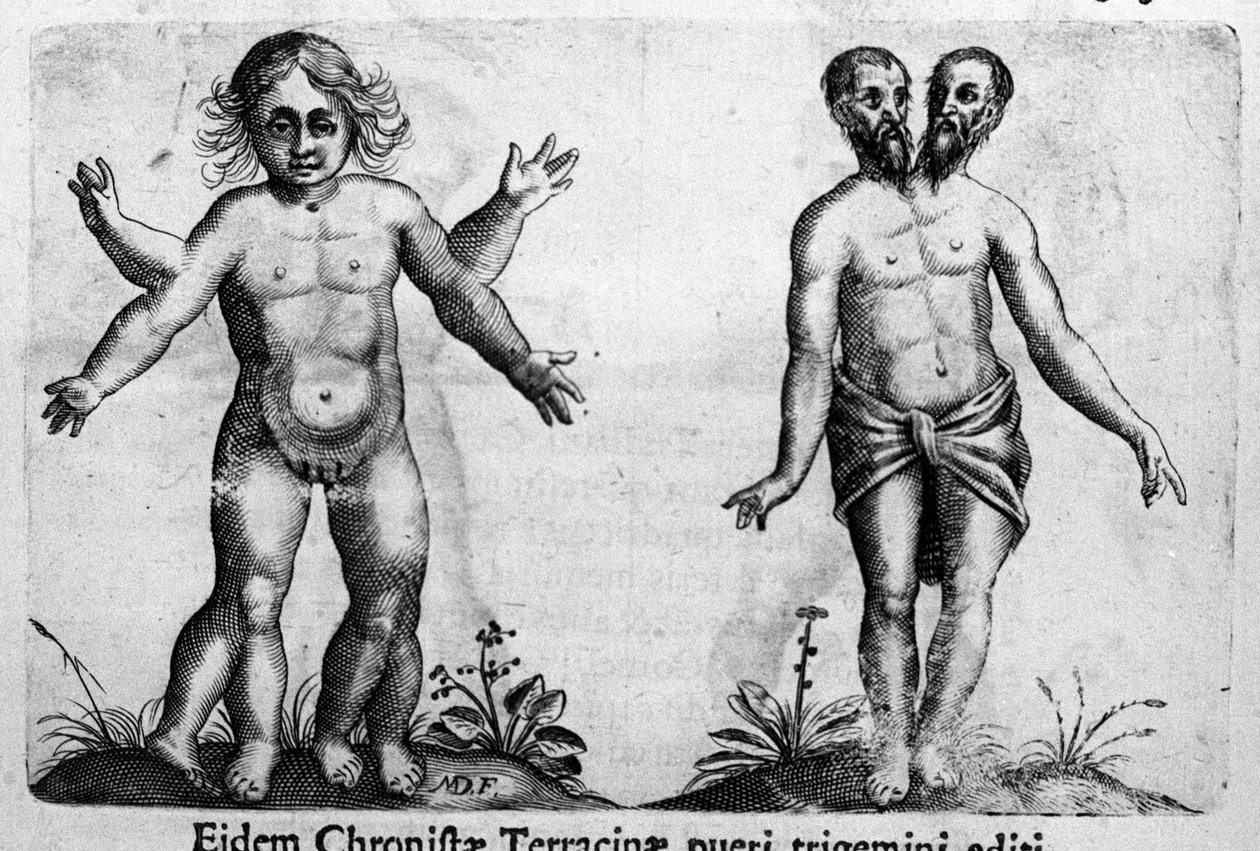 さまざまな種類の人間の怪物 イタリアの科学者Fortunio Liceti（1577-1656）の「De monstrorum natura, causis et differentiis」からの版画。1646 作： イタリア語学校