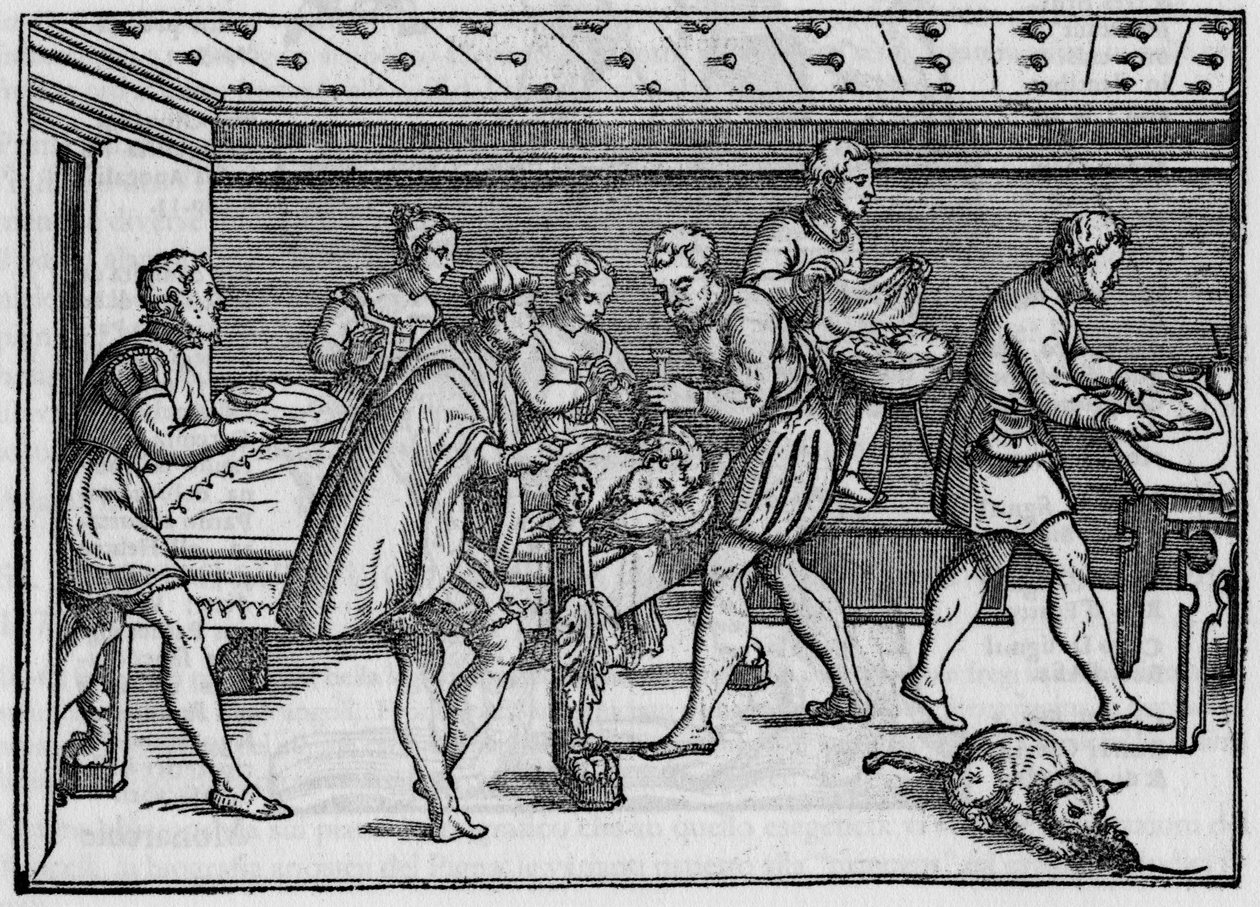 イタリアの外科医ジョバンニ・アンドレア・ダラ・クローチェの「Della Cirurgia」（1574年）に掲載されているエングレーヴィング。 作： イタリア語学校