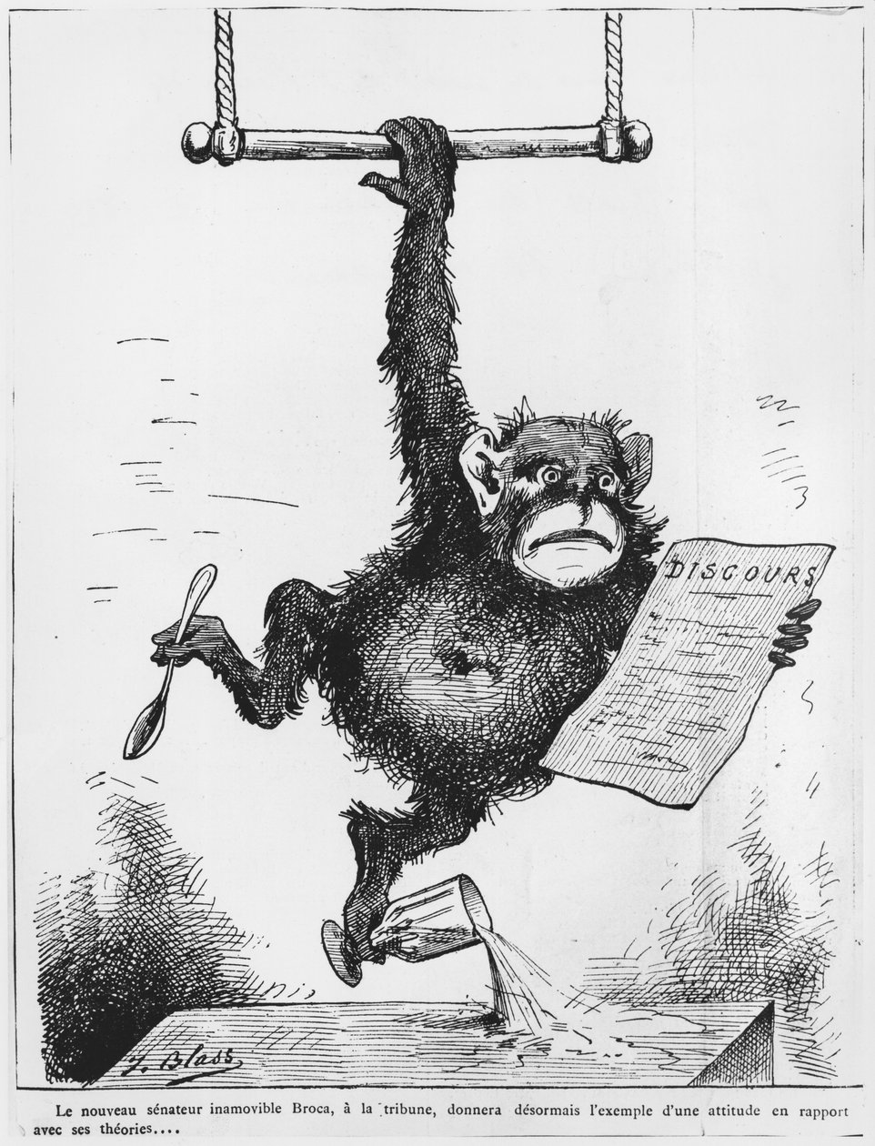 ポールブローカの似顔絵（1824-80）「Le Triboulet」、1880年のイラスト 作： J.ペール