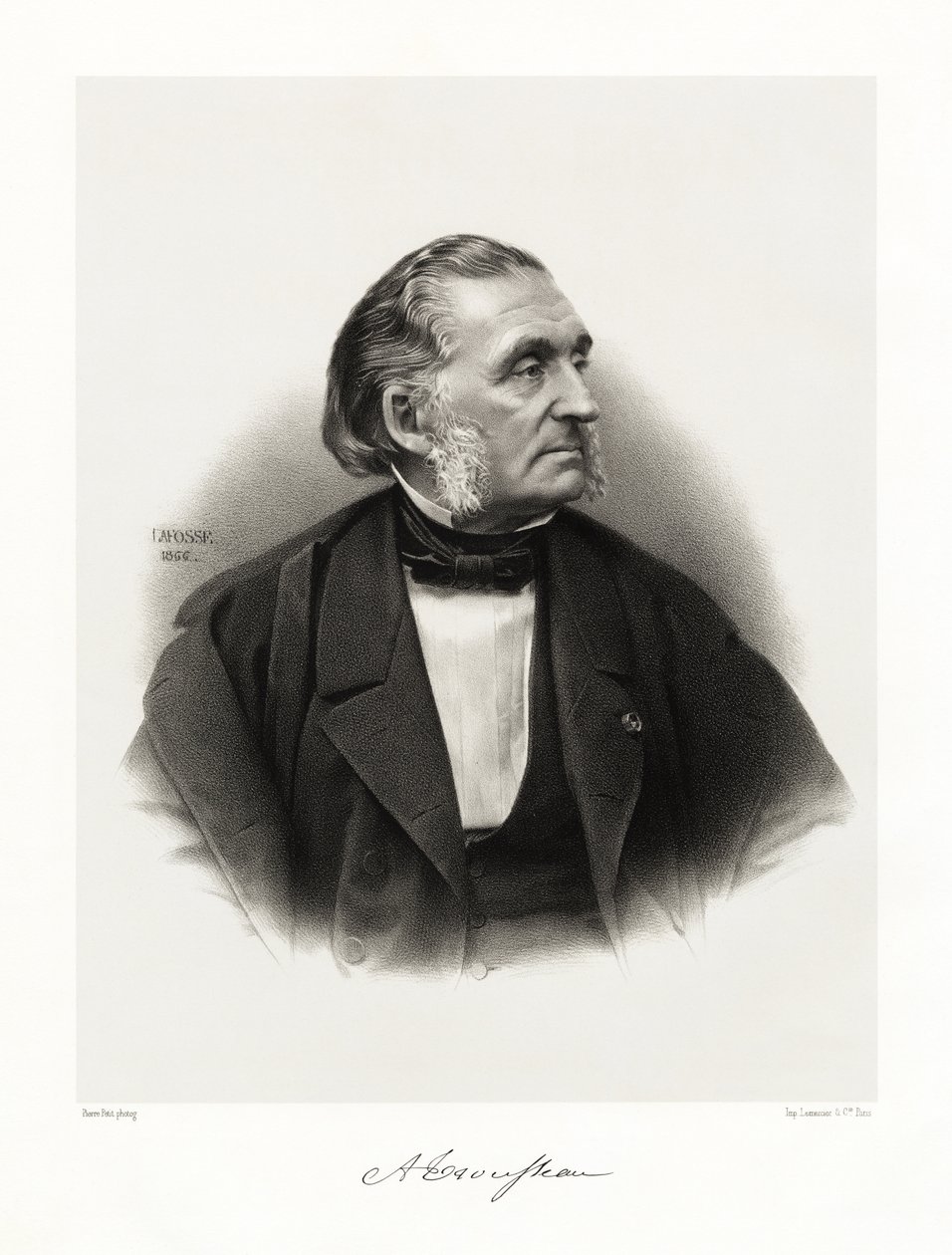 アルマン・トルソー、1865-66 作： ジャン・バプティスト・アドルフ・ラフォッセ