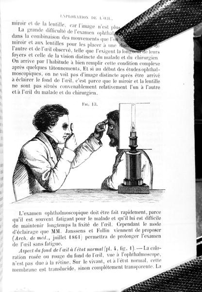 トーマス・ウォートン・ジョーンズ（1808-91）の「眼科医学および外科学の原理と実践に関するマニュアル」をE.フーシェが翻訳した「Traite Pratique des Maladies des Yeux」の図版（1862年にパリで出版）（彫刻）（モノクロ写真）。 作： ジャン・フランソワ・バドゥロー