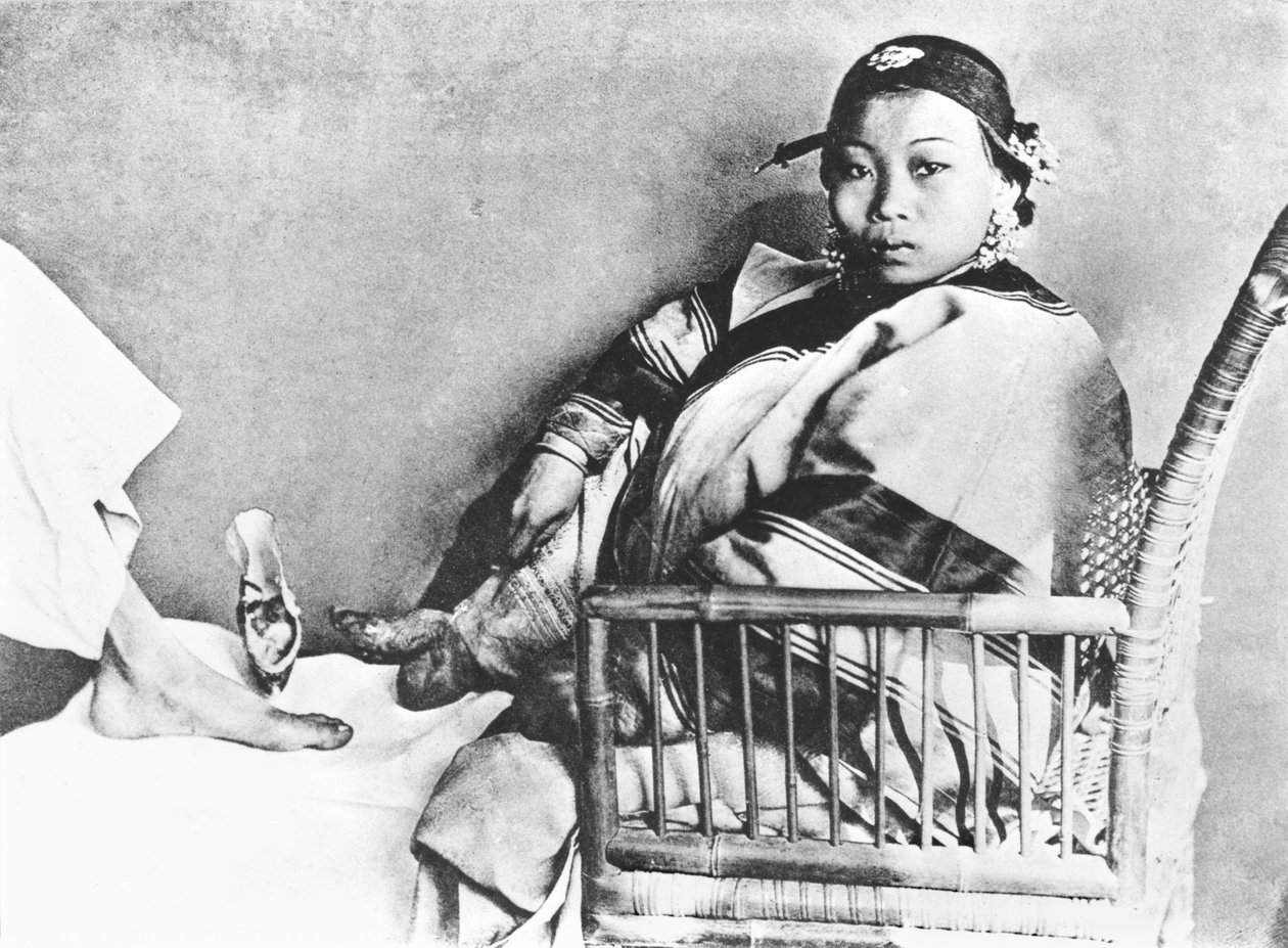 ヨーロッパの足の近くに彼女の覆われていないバインドされた足を示す中国の女性 作： ジョン・トムソン