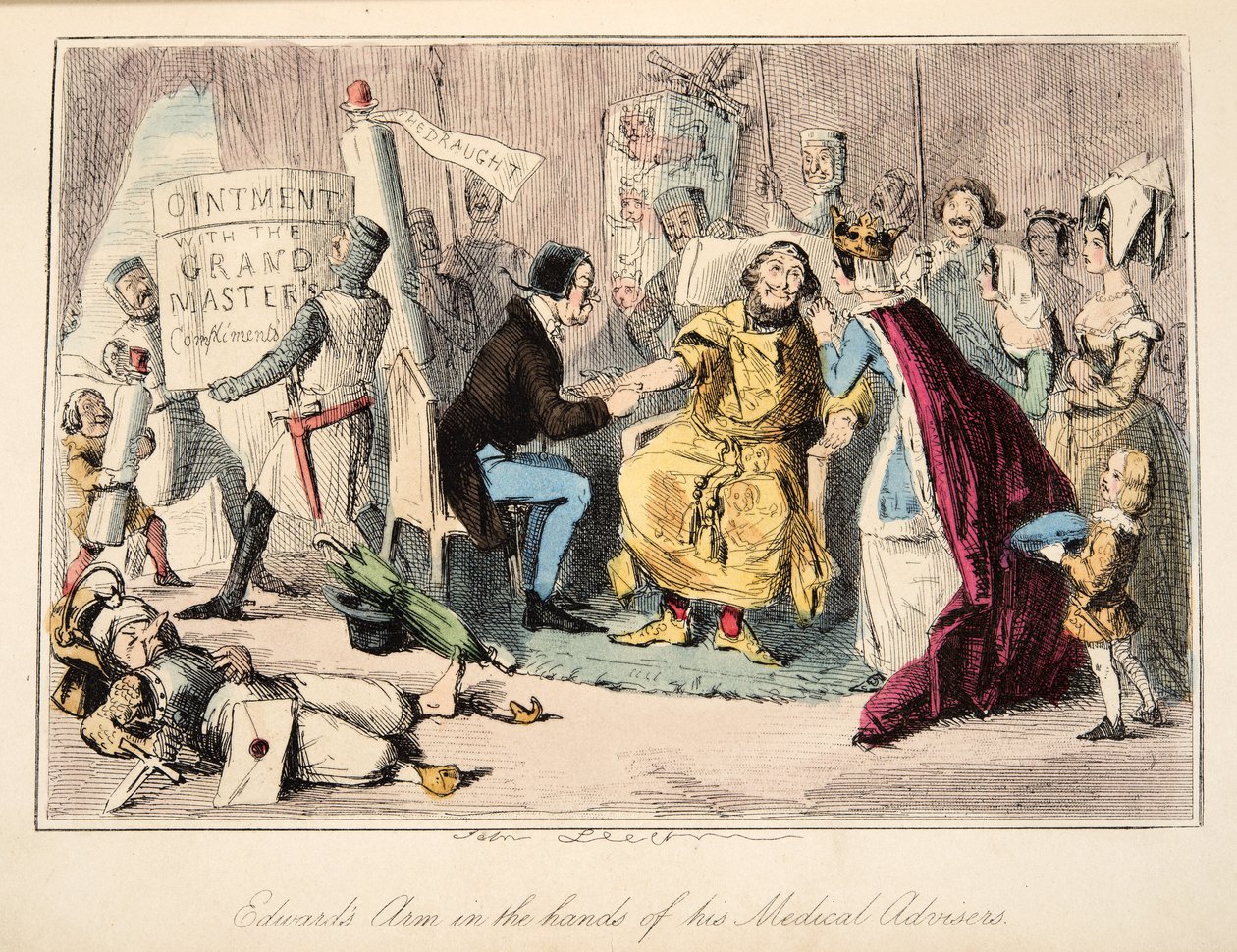 彼の医療アドバイザーの手の中のエドワードの腕、The Comic History of England、パブから。 1864年（手彩色エッチング） 作： ジョン・リーチ