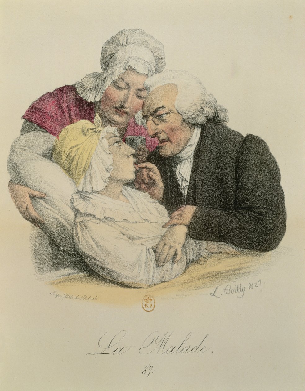 フランソワ・セラフィン・デルペック（1778-1825）1827によって刻まれた患者 作： ルイレオポルドボイリー
