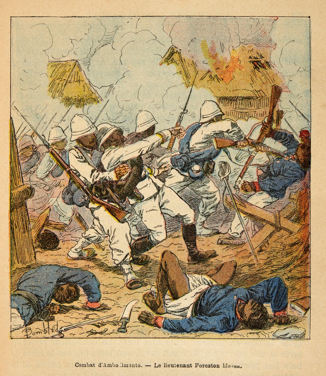 Henri Galli dit Galllichet (1854-1922)著、Louis Bombled (1862-1927)絵による「マダガスカルの戦争-1885-1895年のフランス遠征の逸話史」。1895年のアンボロンティの戦いで負傷したフォレストン中尉、個人蔵 作： ルイ・チャールズ・ボンブル