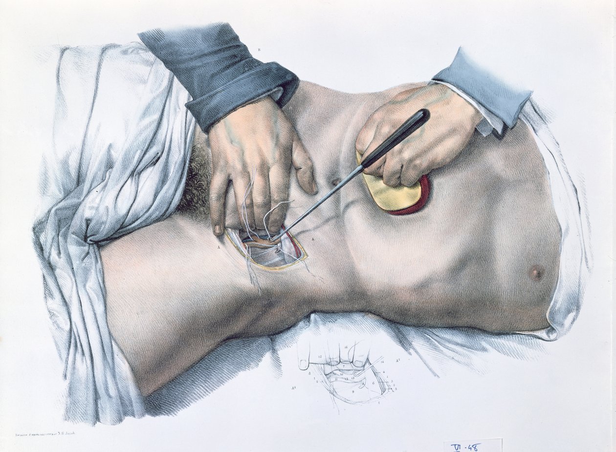 動脈を結ぶ、ジャン・バティスト・マルク・ブールジェリー（1797-1849）1866-67による「Traite Complet de l&39;Anatomie de l&39;Homme」のプレート 作： ニコラ・アンリ・ジェイコブ