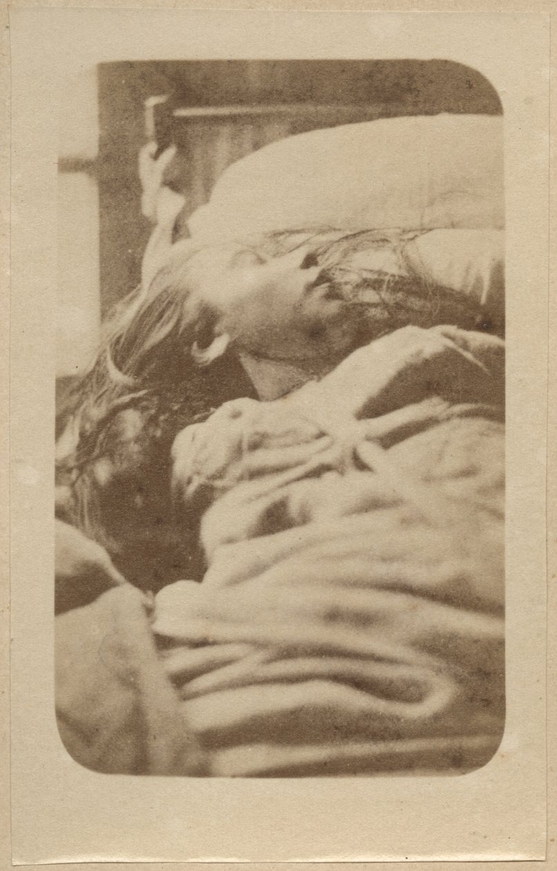 ヒステリーの攻撃、第1フェーズ、Bourneville et P. Regnardによる「Iconographie Photographique de La Salpetriere」のイラスト、プレートII、パリ、1876（アルブメンプリント） 作： ポール・レナード