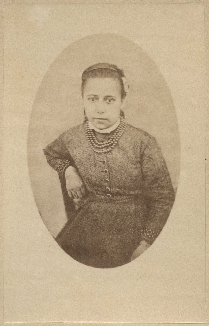 ヒステリー、通常の外観、ボーンヴィルとP.レグナードの「Iconographie Photographique de La Salpetriere」のイラスト、I版、パリ、1876（アルブメンプリント） 作： ポール・レナード