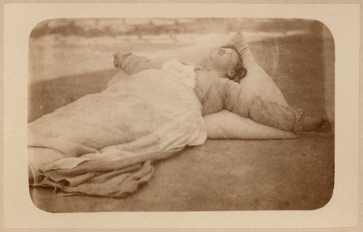 ヒステリーてんかん、攻撃、はりつけ、プレートIXボーンビルとP.レニャール、パリ、1876年の「Iconographie Photographique de La Salpetriere」（アルブメンプリント） 作： ポール・レナード