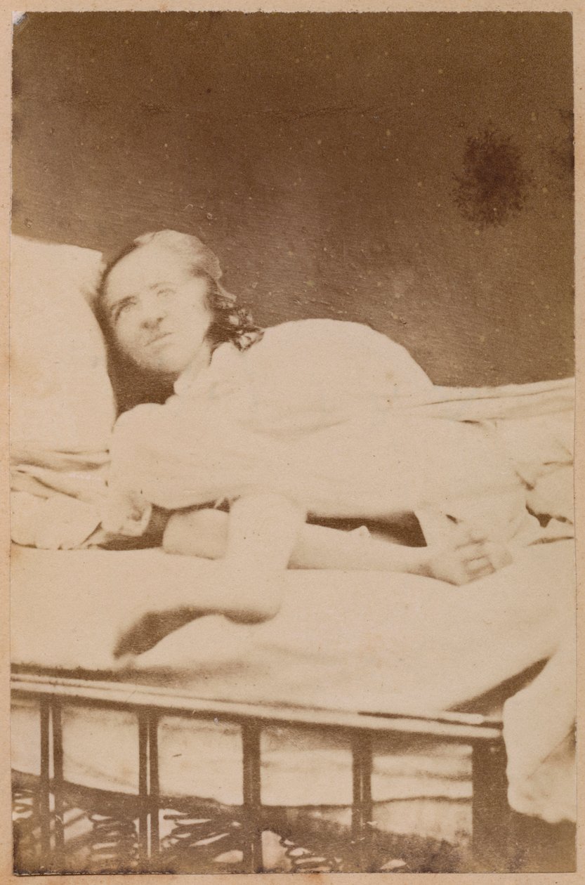 ヒステリーてんかん、ゆがみ、プレートXXXVIII、「Iconographie Photographique de La Salpetriere」Bourneville and P. Regnard、パリ、1876（アルブメンプリント） 作： ポール・レナード