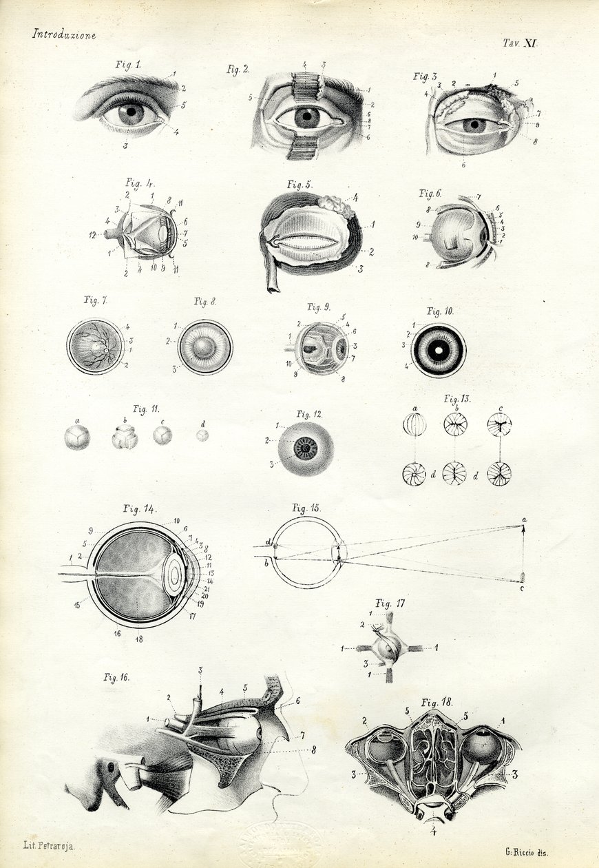 見る器官、1863-79 作： ライムンドペトラロイア