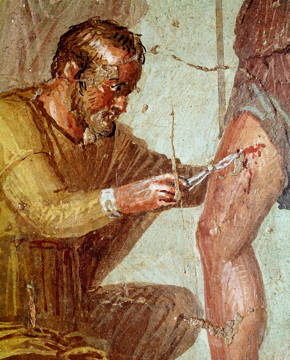 ヴィーナスに助けられたイアピクスに手当てを受けるアエネアス（フレスコ画、AD54-79年） 作： 小説