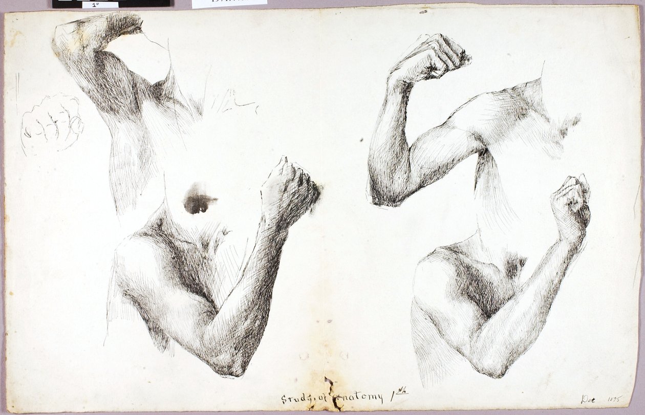 四本の腕の研究 その1 作： ソロン・H・ボーグラム