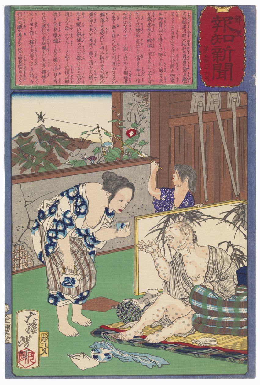らい病の夫・友蔵とともに留まった豊島富代 作： 月岡芳年