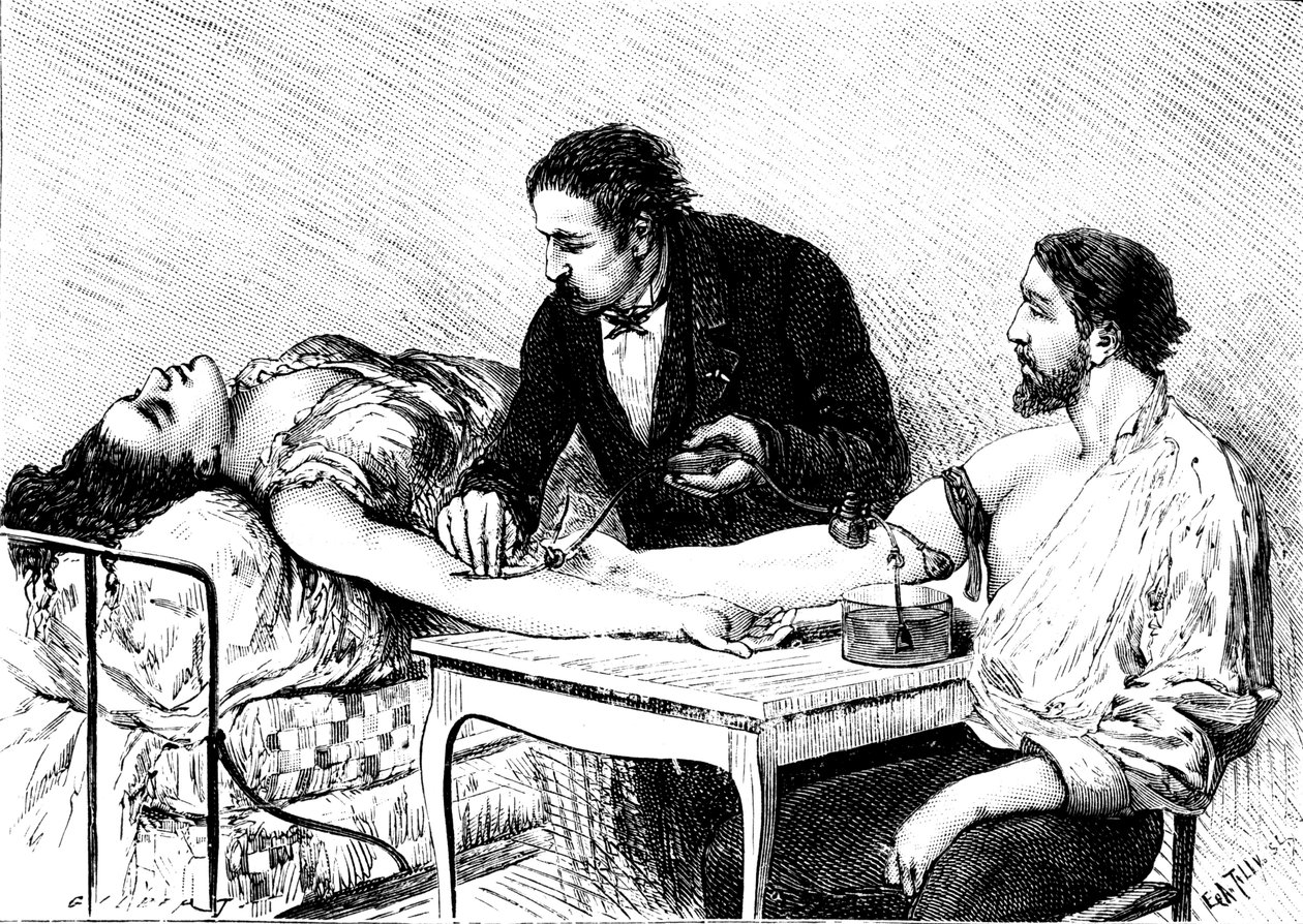 1882年にボランティアから女性に直接輸血を行ったジュネーブのRoussell博士 作： 不明